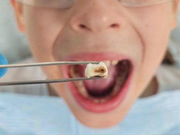 Best Orthodontic Emergency Dentist in Chesapeake Beach, MD